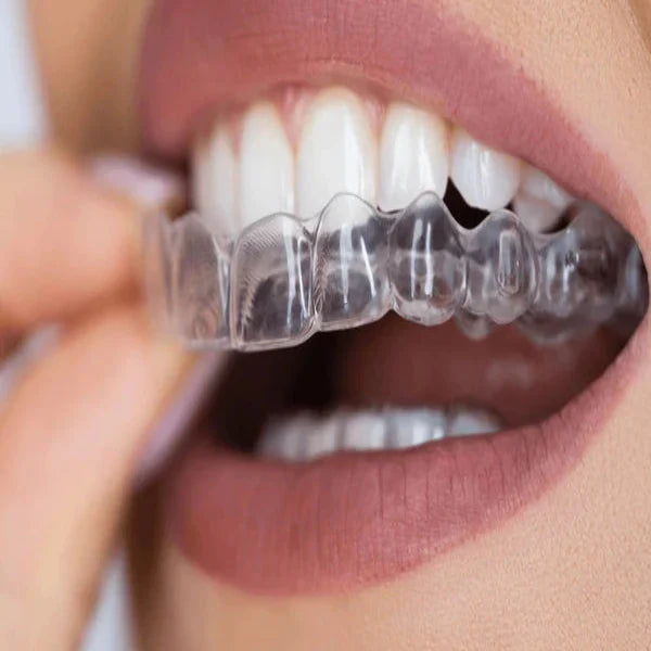 Clear Night Shield Dental Custom Mouldable Nightguard being worn in a mouth with a neutral background